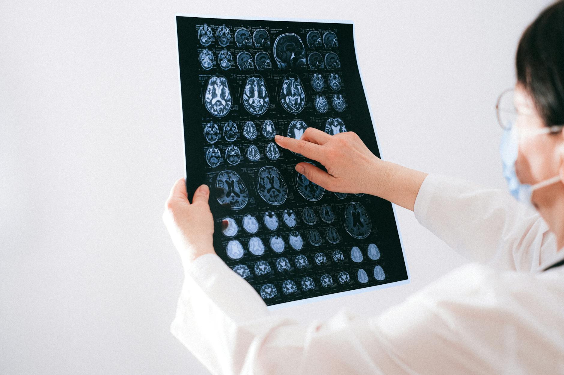 Lekarz analizuje skany MRI mózgu w szpitalu